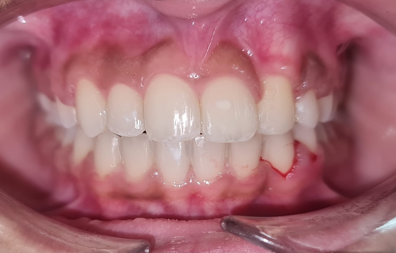 Nethra Kaushik Post Treatment Photo 1